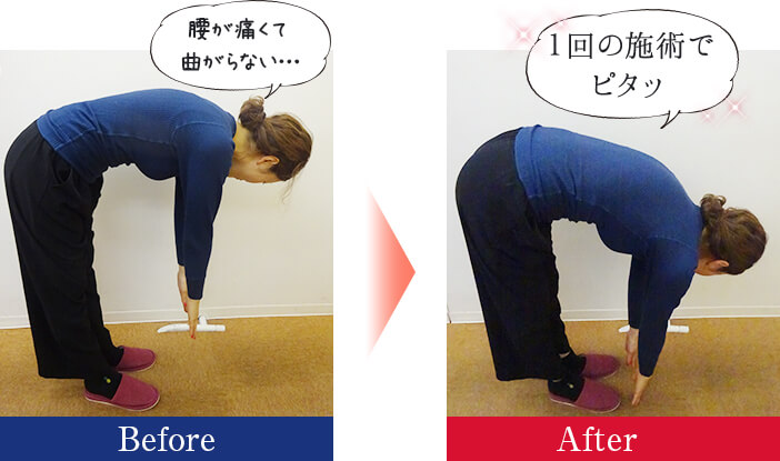 腰の痛みを改善